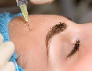 Mesoterapia