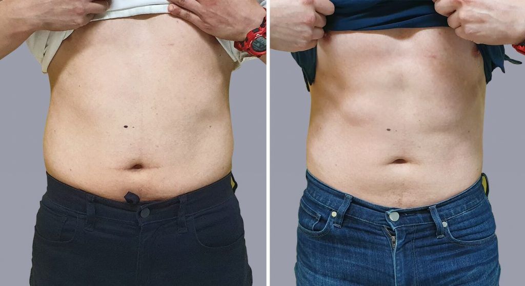 antes-despues-hombre