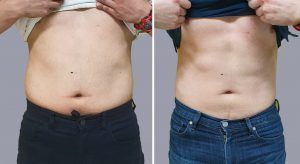 antes-despues-hombre
