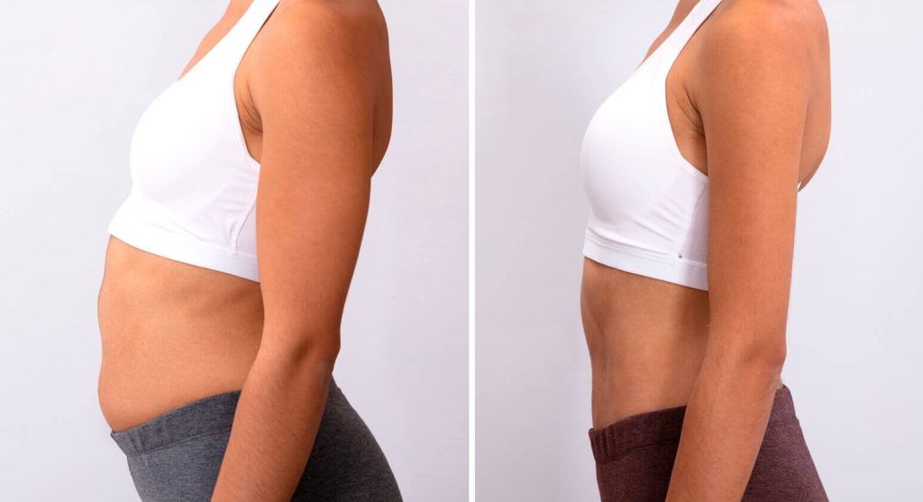 antes-despues-lado-mujer